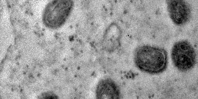 OMS declara fim da emergência em saúde por mpox