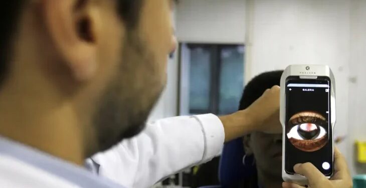 Dia da Saúde Ocular acende alerta para práticas ilegais em ações oftalmológicas em MS