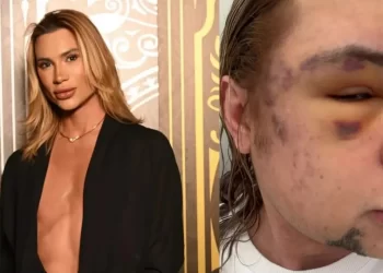 Influenciador Junior Dutra morre após procedimento estético malsucedido