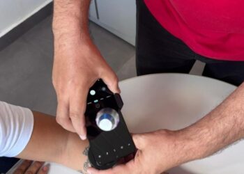 Telediagnóstico em dermatologia amplia acesso e identifica casos de câncer de pele em MS