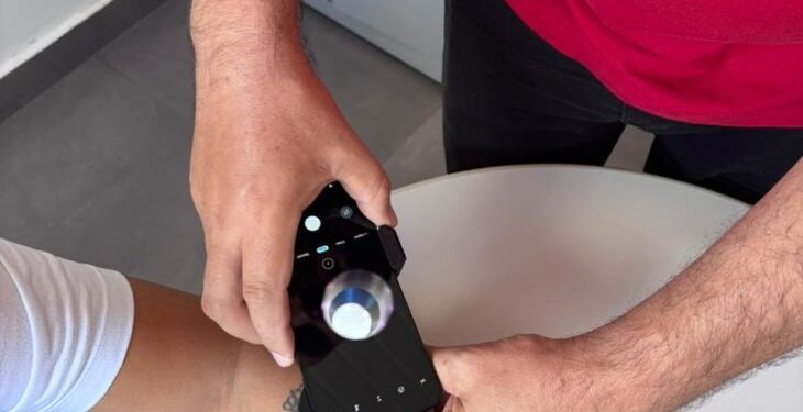 Telediagnóstico em dermatologia amplia acesso e identifica casos de câncer de pele em MS